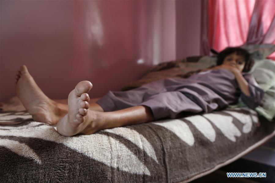YEMEN-SANAA-CHILDREN-MALNUTRITION