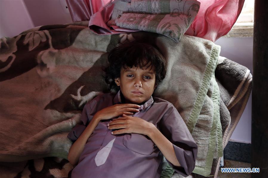 YEMEN-SANAA-CHILDREN-MALNUTRITION
