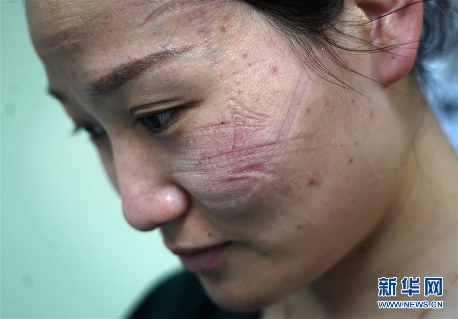 (聚焦疫情防控)(7)“最美印痕”